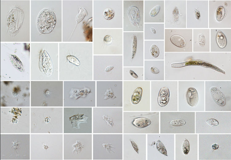 同时,初步建立起全国首家纤毛虫基因库