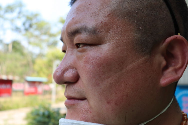 最美战疫印记:"口罩脸",只为百姓守好"门"