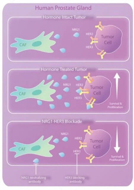 读创 Cancer Cell 张则达等发现前列腺肿瘤耐药性 生存信号