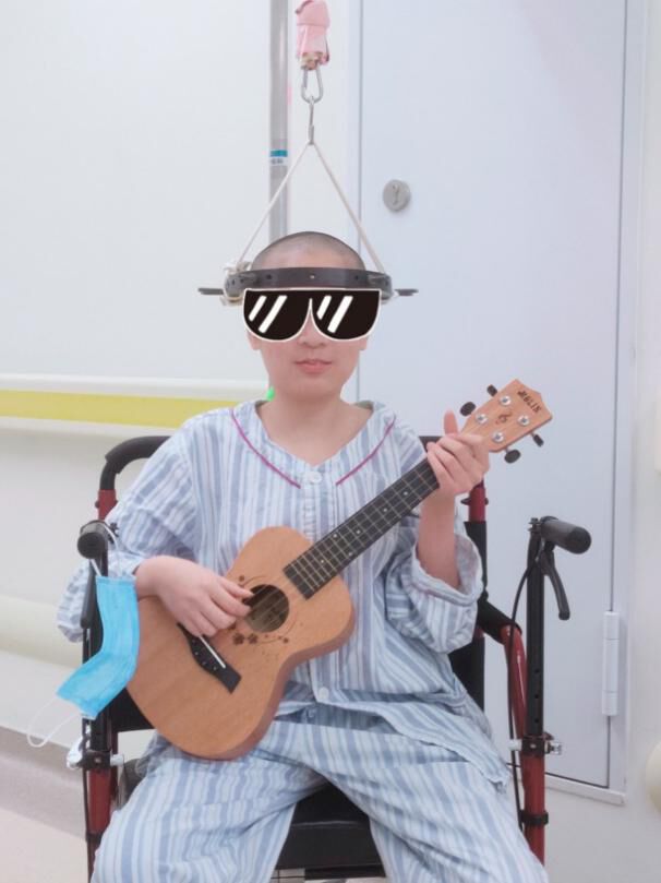 小邓正在进行颅骨头环牵引治疗