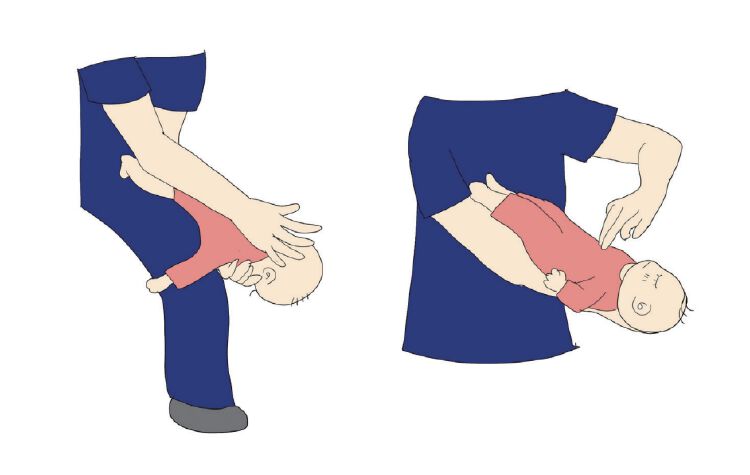 每个家庭必须学会的海姆立克腹部冲击急救法家长必读